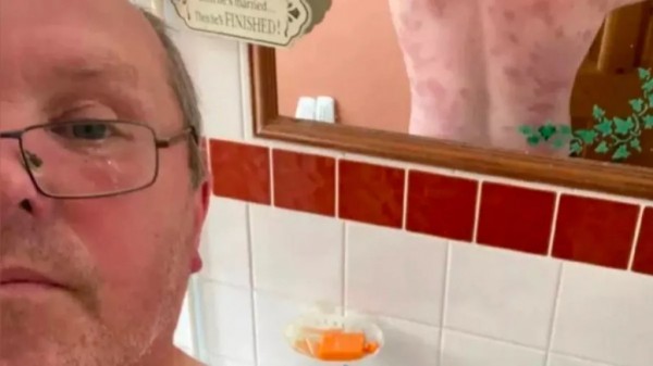 Мужчина выжил после 240 укусов ос Мужчина выжил после 240 укусов ос